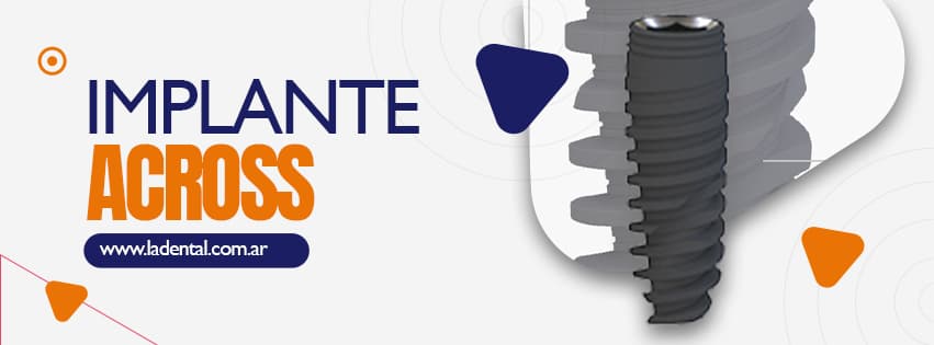 IMPLANTE ACROSS (TQU4TRO)
