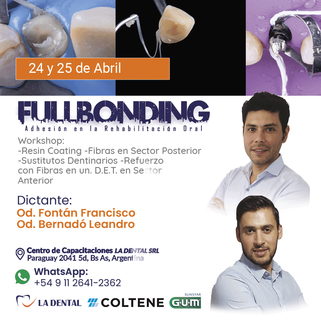 Curso de FULL BONDING¿Cuándo? Inicia el 24 y 25 de abril, junto al Od. Fontán Francisco y el Od. Bernadó Leandro.